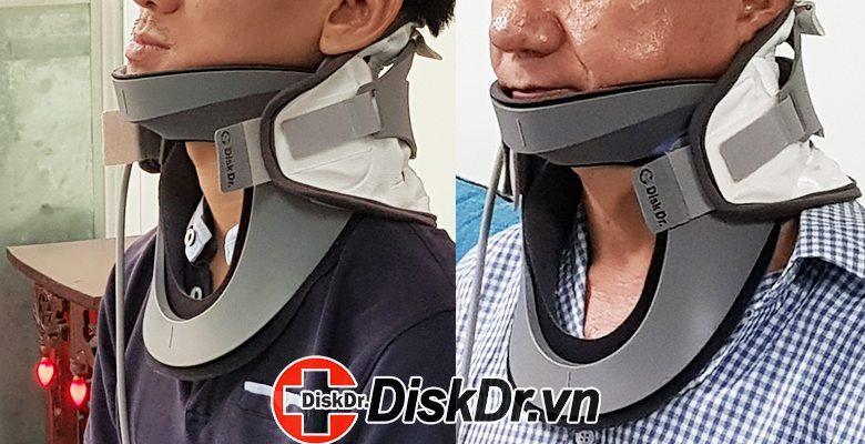 Đai cổ kéo giãn cột sống DiskDr. CS300