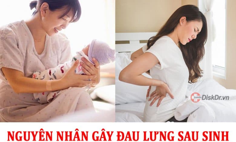 Nguyên nhân gây ra những cơn đau lưng sau khi sinh