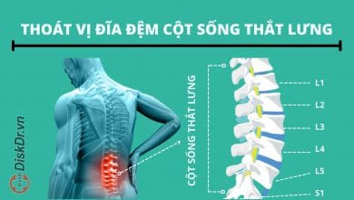 Thoát vị đĩa đệm cột sống thắt lưng là gì?