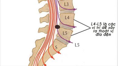 Vị trí đốt sống L4 L5