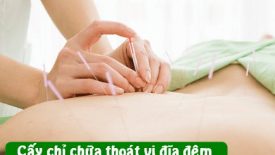 cấy chỉ chữa thoát vị đĩa đệm giá bao nhiêu?